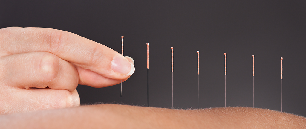 Acupuncture for Health thumbnail